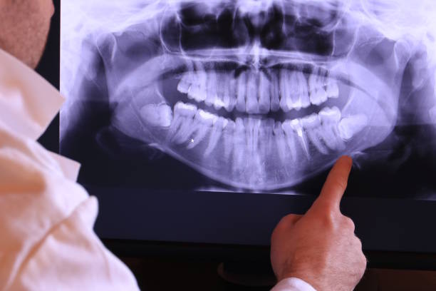 Best Holiday Emergency Dentist in Webster, SD
